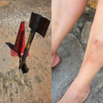Buraco no Centro Histórico de Pirenópolis provoca acidente com turista