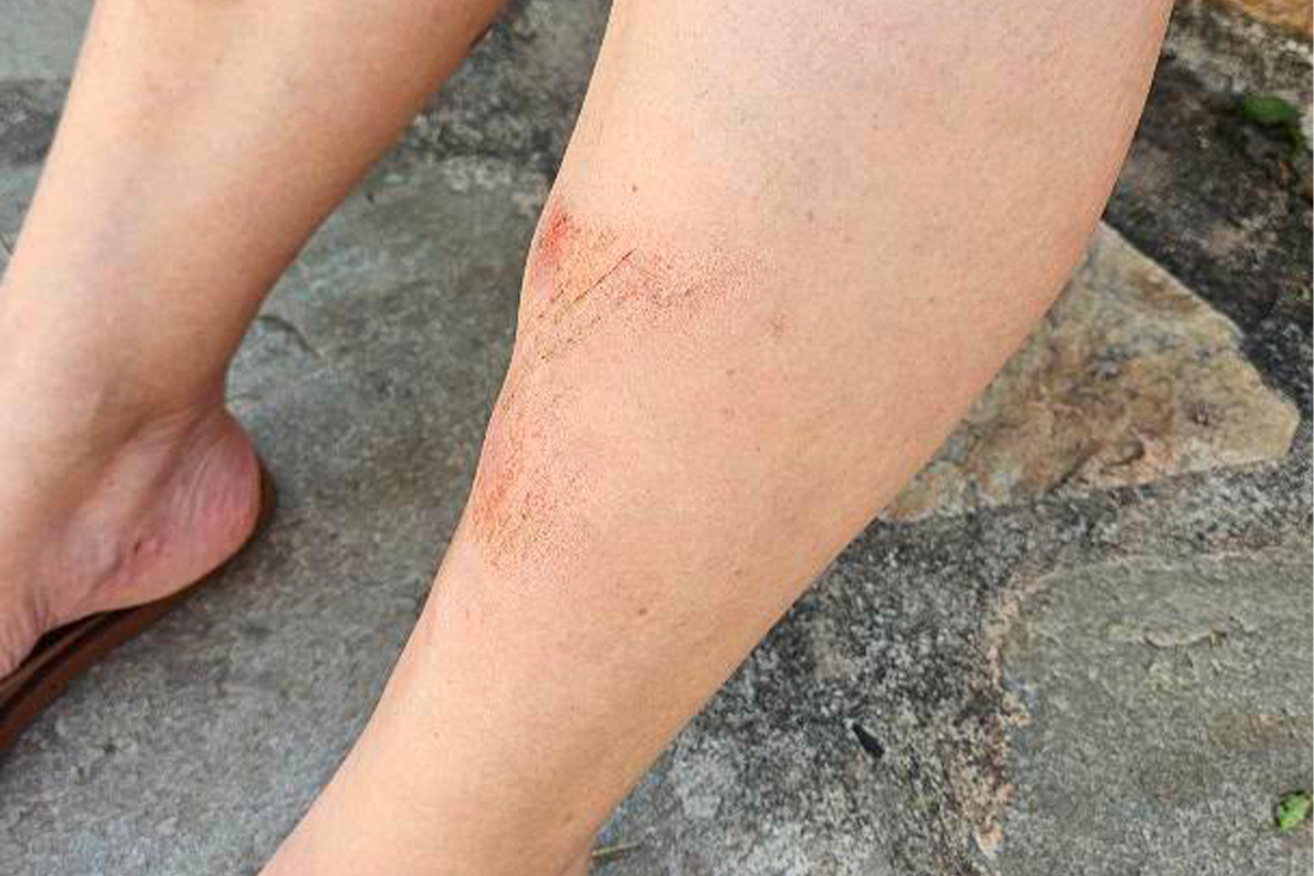 Buraco no Centro Histórico de Pirenópolis provoca acidente com turista