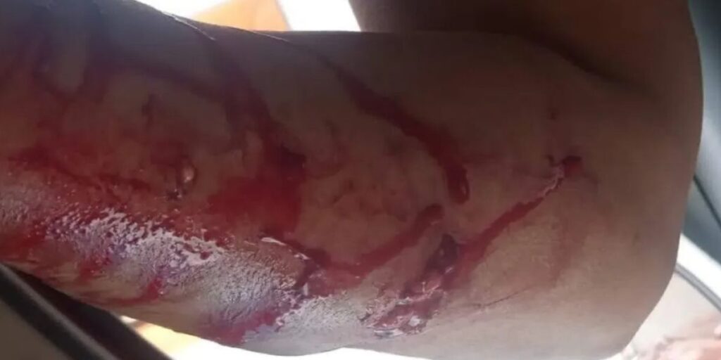 Dois Pitbulls 4tacam senhora em Pirenópolis - IMAGEM SENSIVEL 5